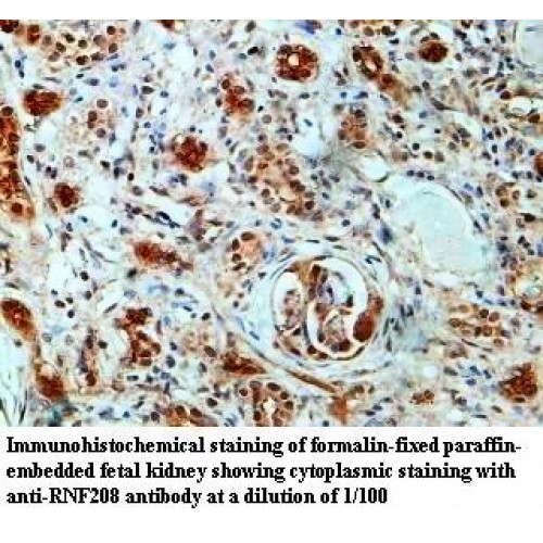 RNF208 Antibody
