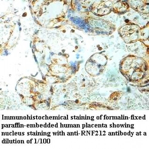 RNF212 Antibody