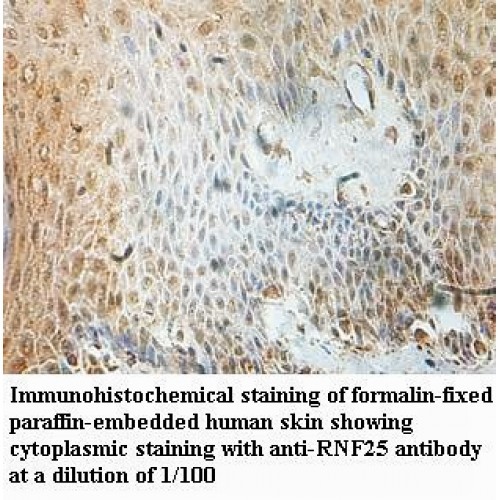 RNF25 Antibody
