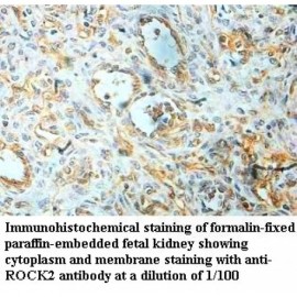 ROCK2 Antibody