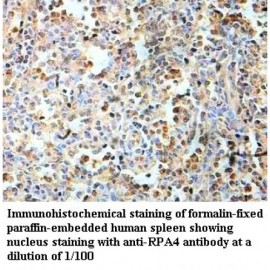 RPA4 Antibody