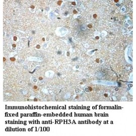 RPH3A Antibody