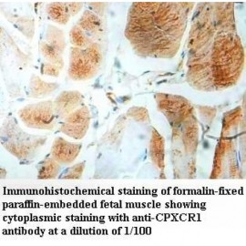 CPXCR1 Antibody