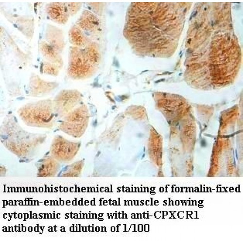 CPXCR1 Antibody