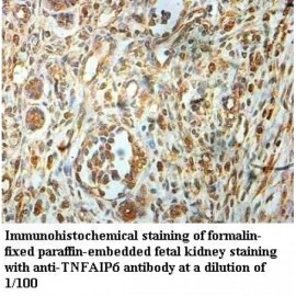 TNFAIP6 Antibody