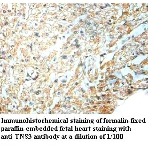 TNS3 Antibody