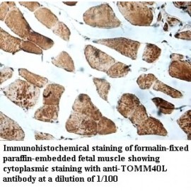TOMM40L Antibody