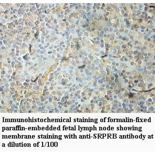 SRPRB Antibody