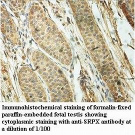 SRPX Antibody