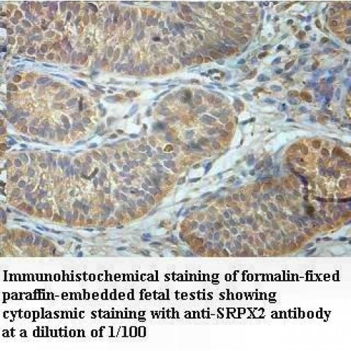 SRPX2 Antibody