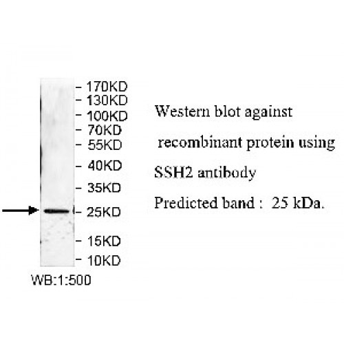 SSH2 Antibody