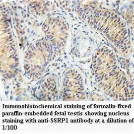 SSRP1 Antibody