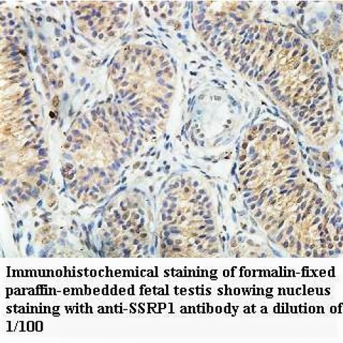 SSRP1 Antibody
