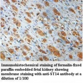 ST14 Antibody