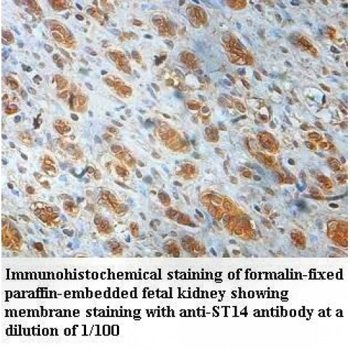 ST14 Antibody