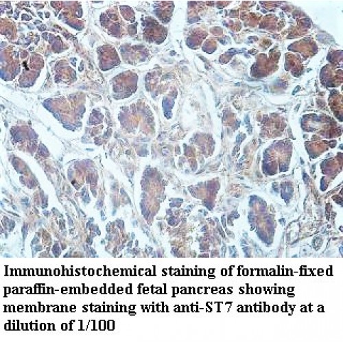 ST7 Antibody