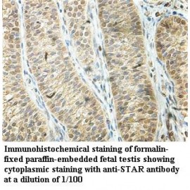 STAR Antibody