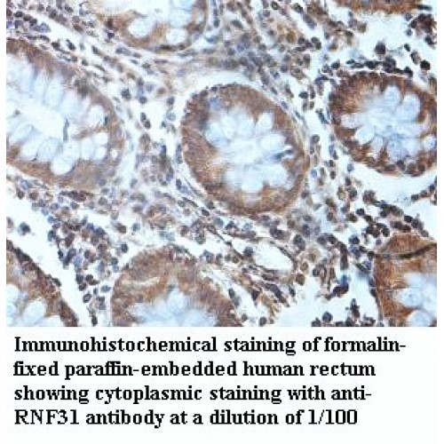 RNF31 Antibody