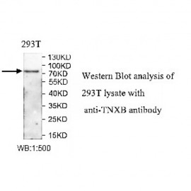 TNXB Antibody
