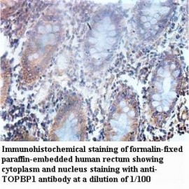 TOPBP1 Antibody