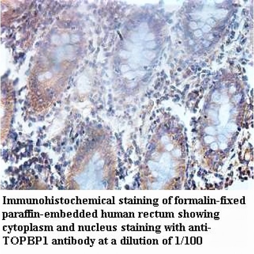 TOPBP1 Antibody