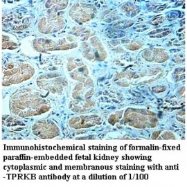 TPRKB Antibody