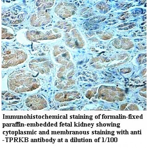 TPRKB Antibody