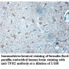 TPH2 Antibody