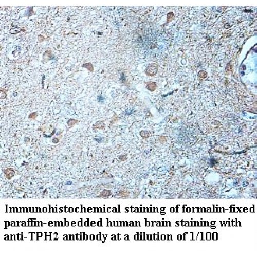 TPH2 Antibody