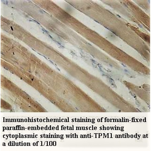 TPM1 Antibody