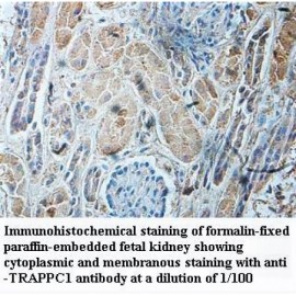 TRAPPC1 Antibody