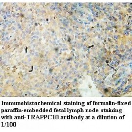 TRAPPC10 Antibody