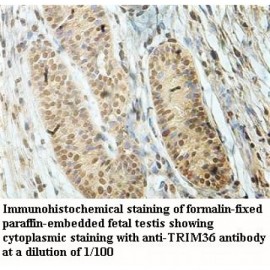 TRIM36 Antibody
