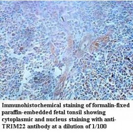 TRIM22 Antibody