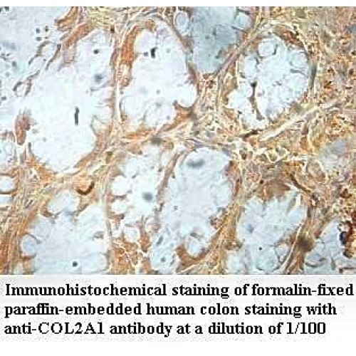 COL2A1 Antibody