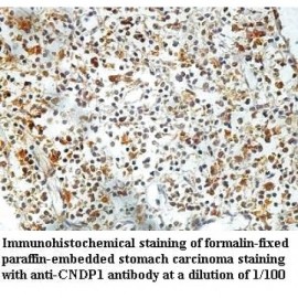 CNDP1 Antibody