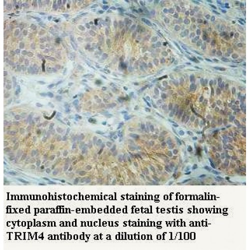 TRIM4 Antibody