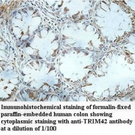 TRIM42 Antibody