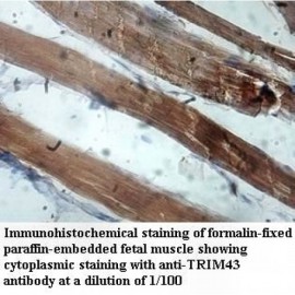 TRIM43 Antibody
