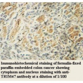 TRIM47 Antibody