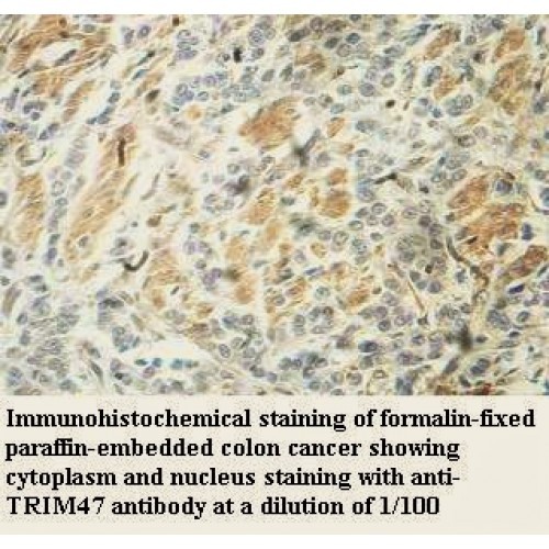 TRIM47 Antibody