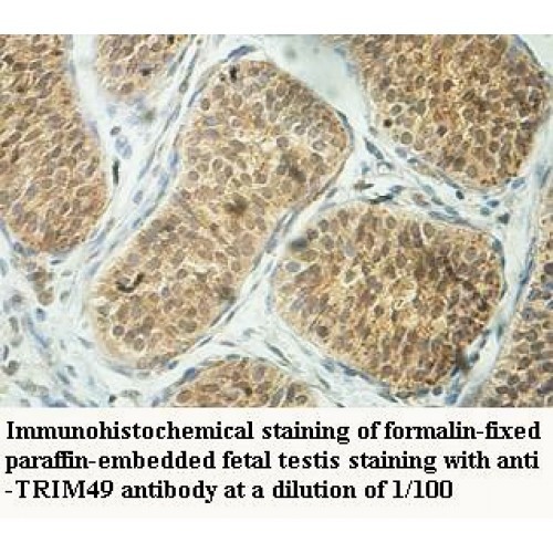TRIM49 Antibody