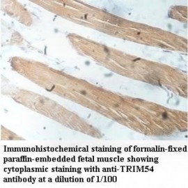 TRIM54 Antibody