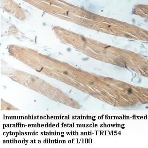 TRIM54 Antibody