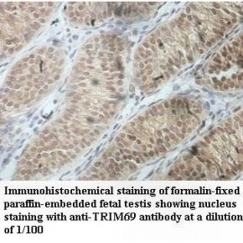 TRIM69 Antibody