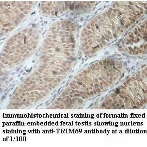 TRIM69 Antibody