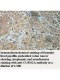 CORO2A Antibody