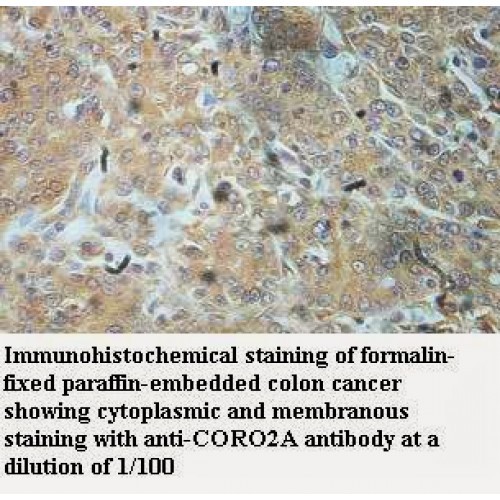 CORO2A Antibody