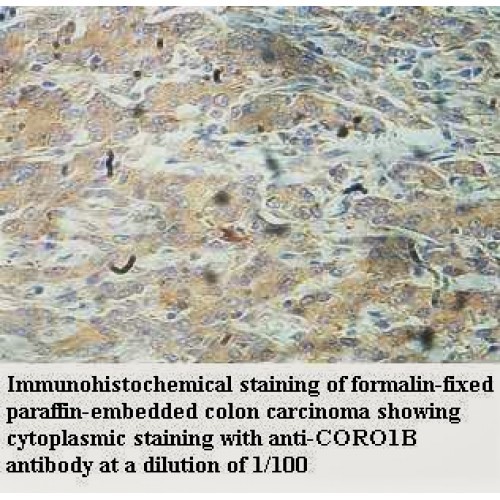 CORO1B Antibody