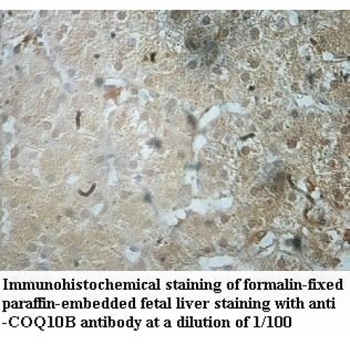 COQ10B Antibody